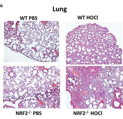 Corrigendum: The Nrf2-Antioxidant Response Element Signaling Pathway Controls Fibrosis and Autoimmunity in Scleroderma